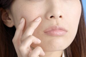 彼氏のニキビ、うつる可能性と予防策を探る!接触によるリスクと対策!