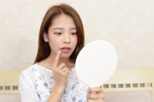 DUO製品でニキビが増えた？その原因と対策